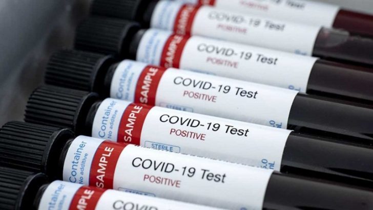 Tres nuevos casos de coronavirus en Loncopué: 57, 39 y 2 años