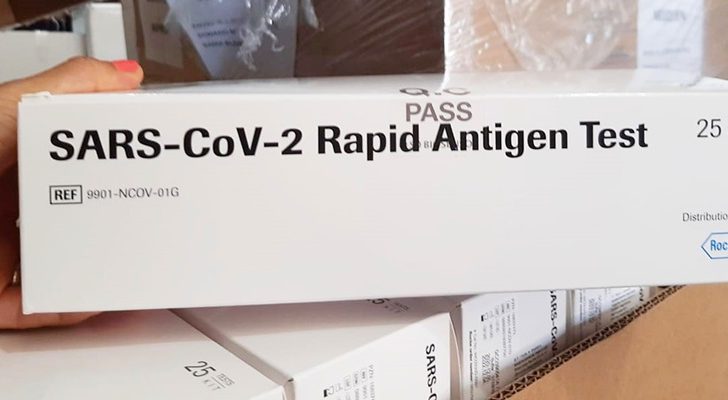 Salud compró 30 mil test rápidos para COVID-19